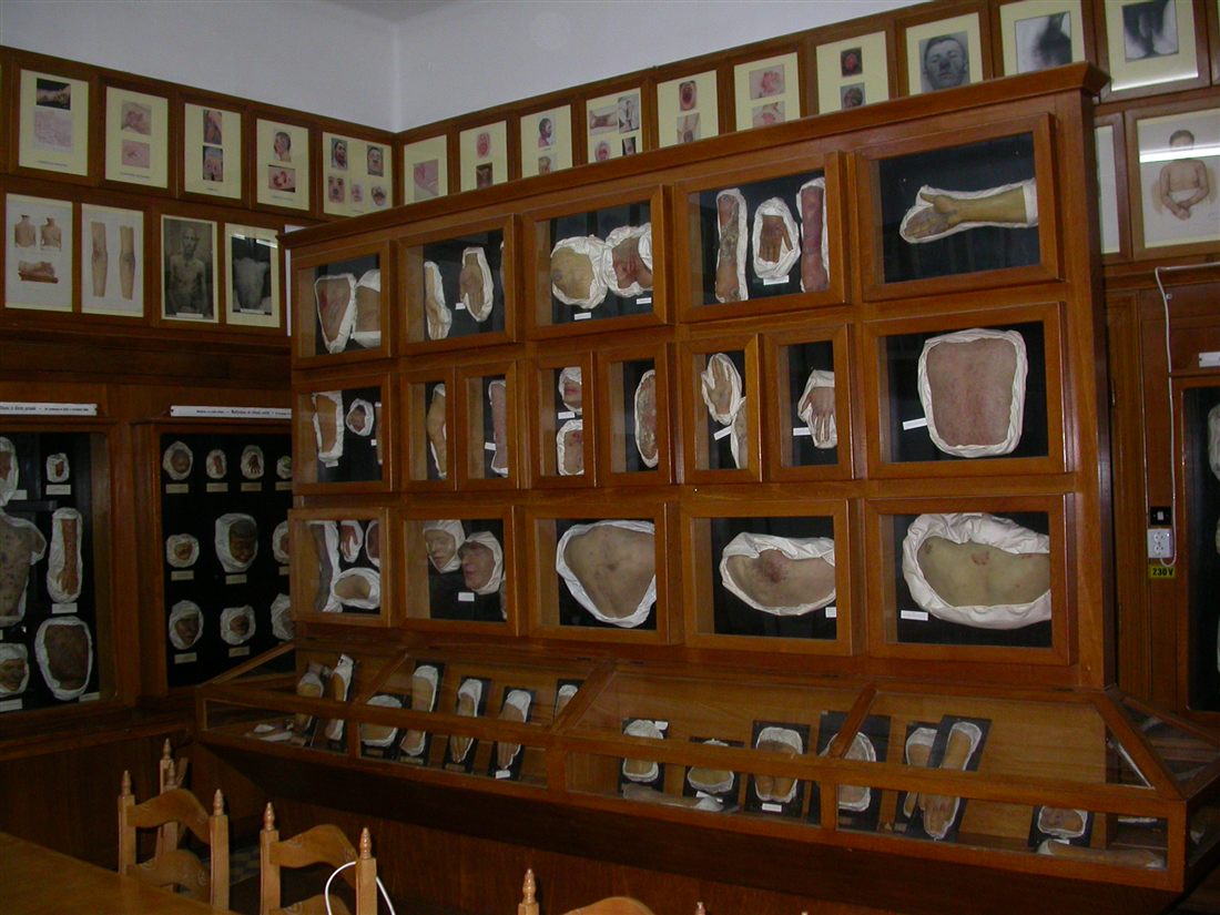 The moulage museum, awarded in Budapest in 1935